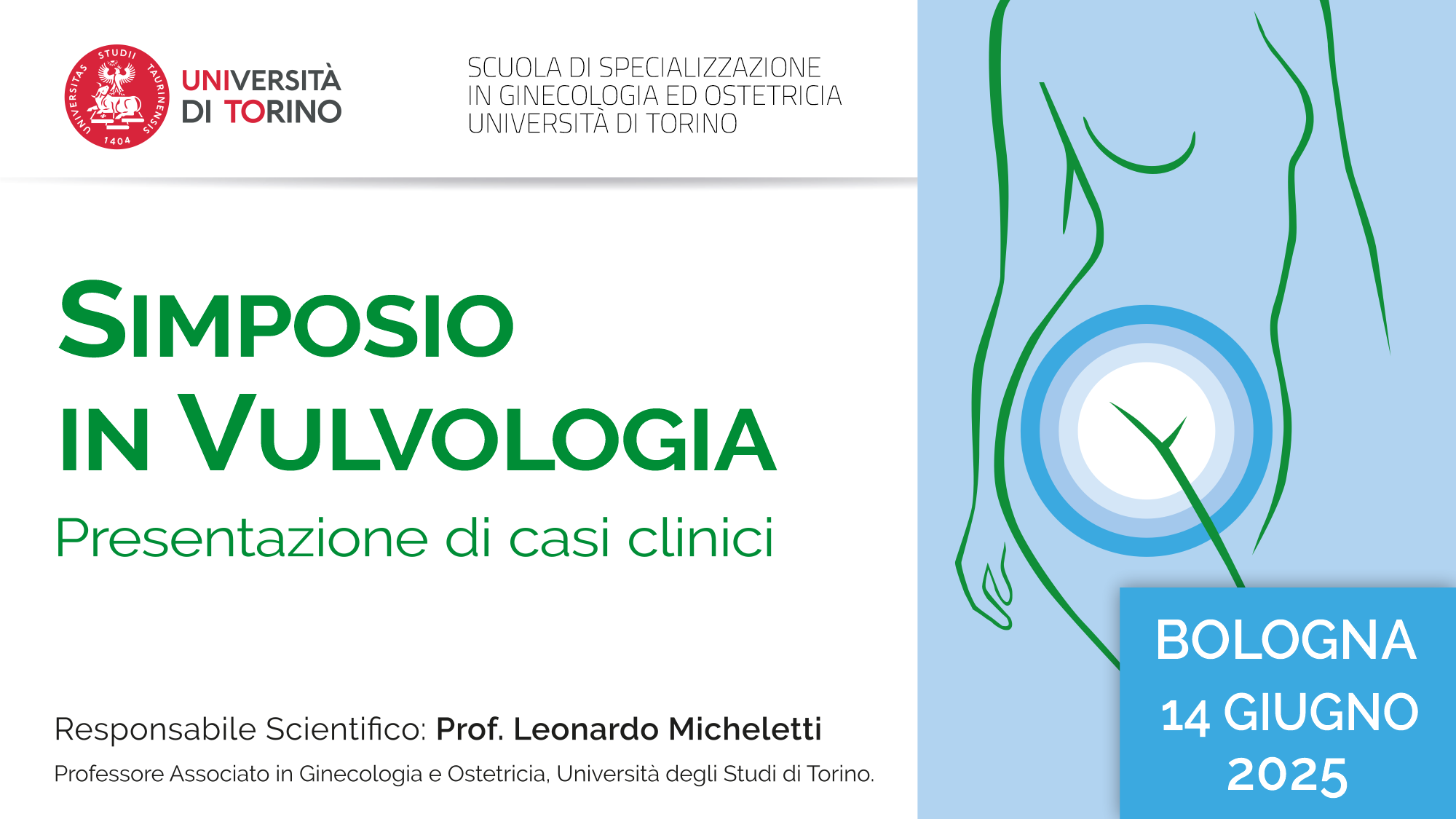 tappo_14giugno2025_Bologna